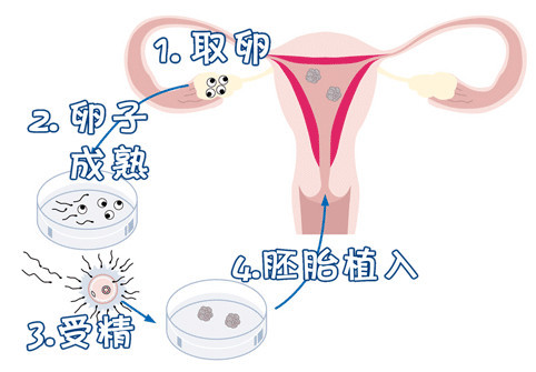 冰原生殖医学中心